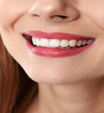 collage-with-photos-woman-before-after-teeth-whitening-closeup (1) 1 (1)