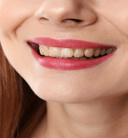 collage-with-photos-woman-before-after-teeth-whitening-closeup (1) 1