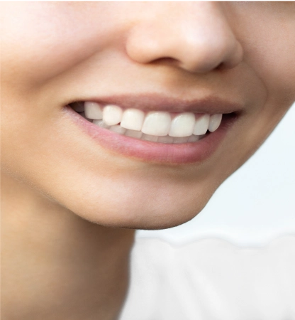 young-woman-s-smile-before-after-teeth-straightening-ideal-beautiful-shape-teeth 2 (1)