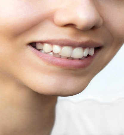 young-woman-s-smile-before-after-teeth-straightening-ideal-beautiful-shape-teeth 2