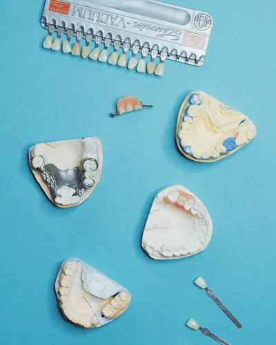 All on 4 Implants procedure at The Dental Club