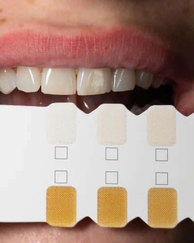 dental club services procedure photo