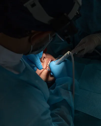 Fluoride Treatment procedure at The Dental Club