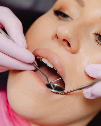 Gum Disease Treatment procedure at The Dental Club