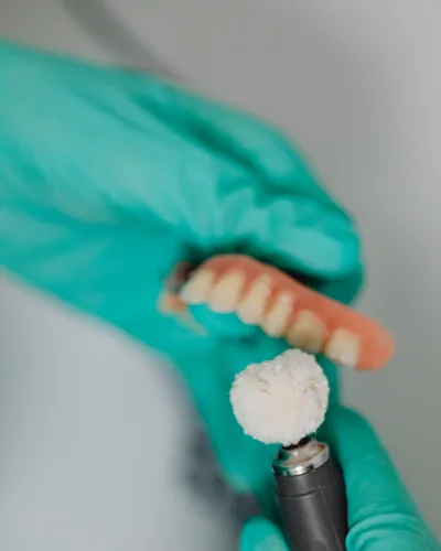 Implant Dentures procedure at The Dental Club